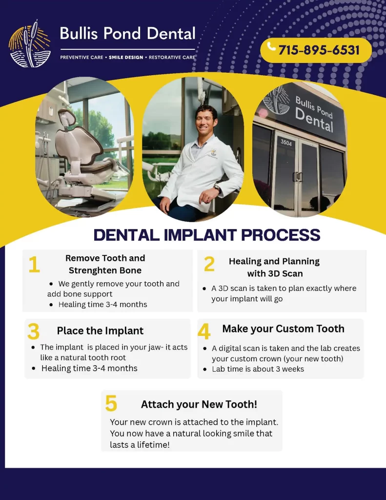 Dental Implant Procedure Flyer