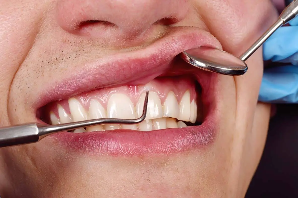Periodontal Therapies