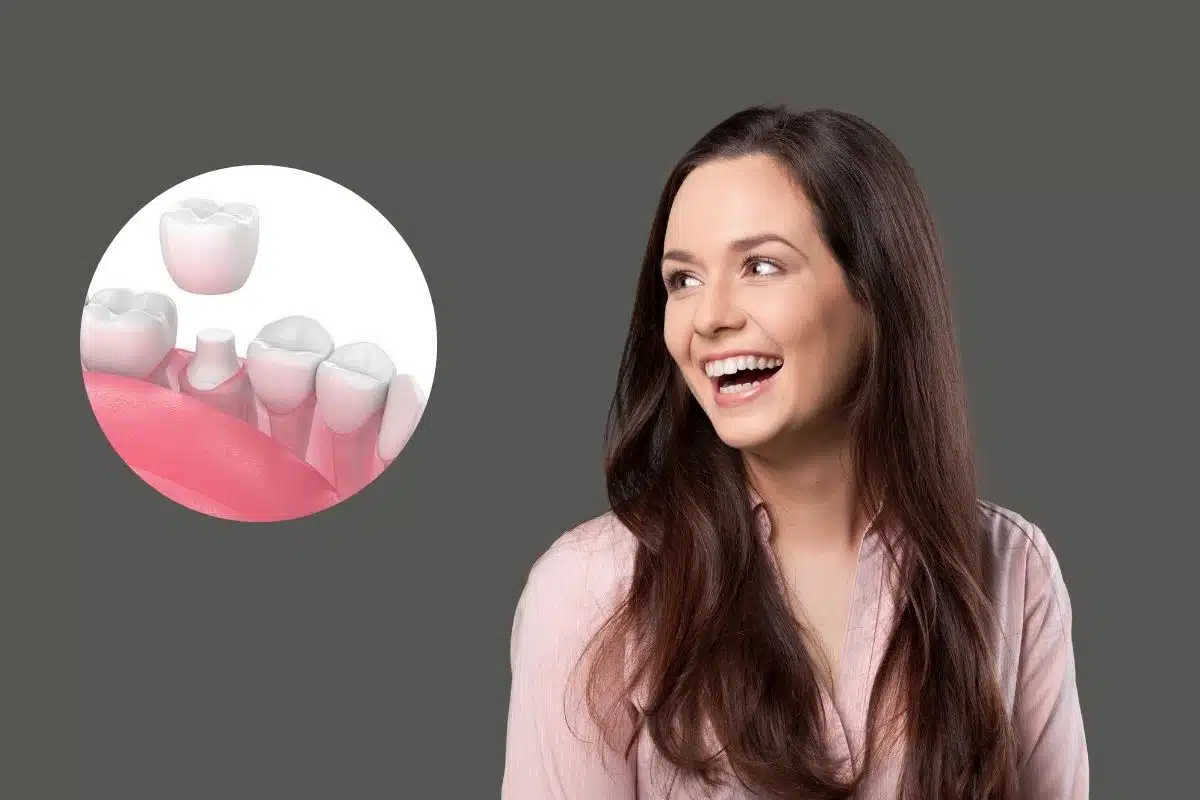 Same Day Dental Crowns