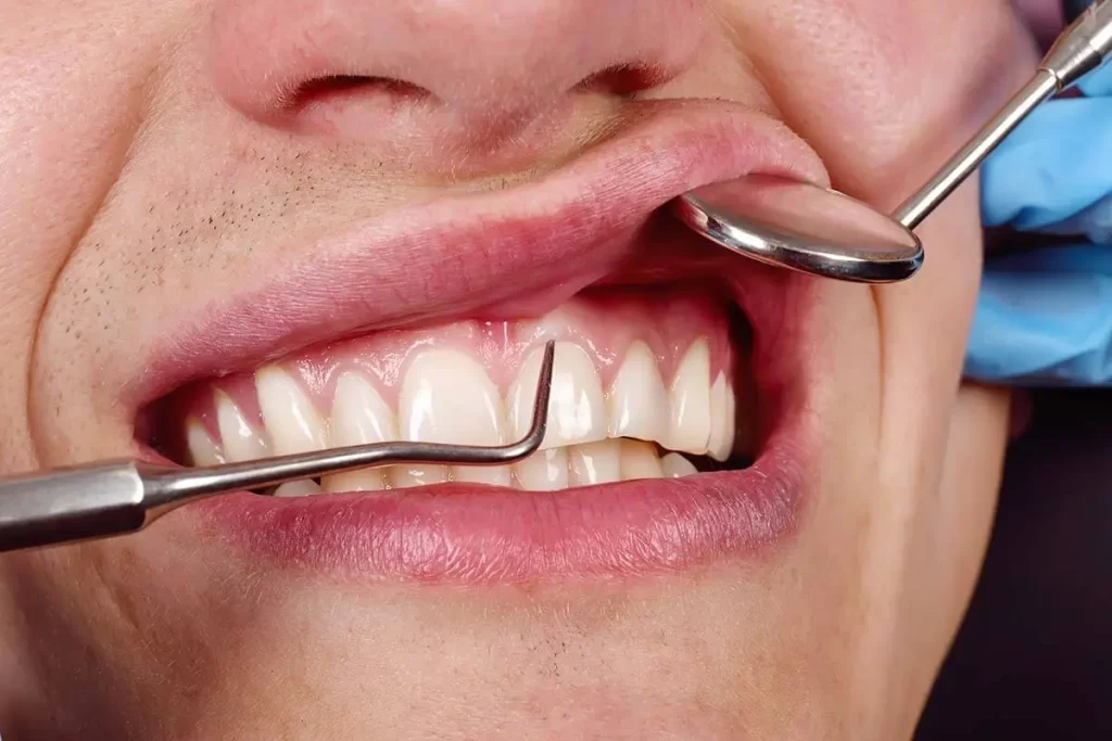 Periodontal Therapies Promo